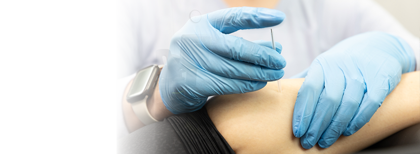 Dry needling in Greensboro